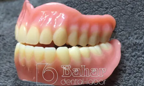 Total Protez (CAD/CAM) diş protezleri