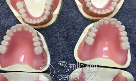 Total Protez (CAD/CAM)