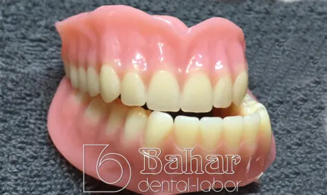 Total Protez (CAD/CAM) dental protezleri