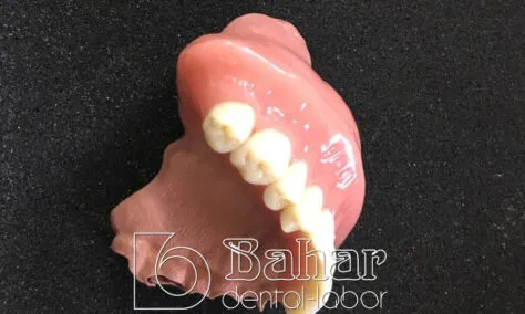 Total Protez (CAD/CAM) istanbul diş laboratuvarı