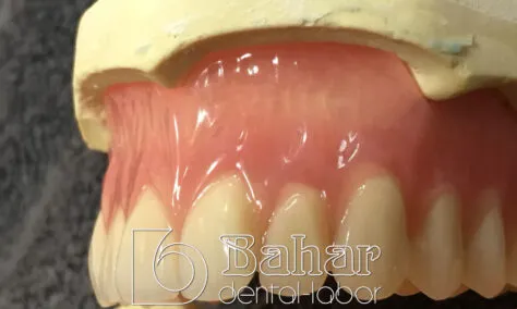 Total Protez (CAD/CAM)